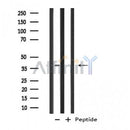 DF4574 staining Hela by IF/ICC. The sample were fixed with PFA and permeabilized in 0.1% Triton X-100,then blocked in 10% serum for 45 minutes at 25¡ãC. The primary antibody was diluted at 1/200 and incubated with the sample for 1 hour at 37¡ãC. An  Alexa Fluor 594 conjugated goat anti-rabbit IgG (H+L) Ab, diluted at 1/600, was used as the secondary antibod