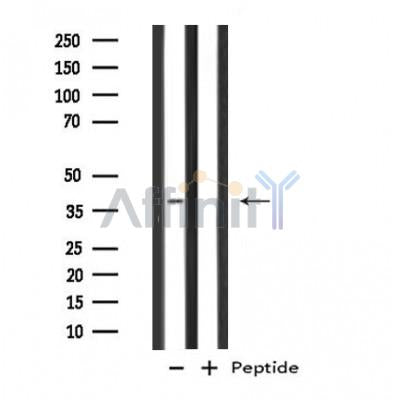 DF4574 staining Hela by IF/ICC. The sample were fixed with PFA and permeabilized in 0.1% Triton X-100,then blocked in 10% serum for 45 minutes at 25¡ãC. The primary antibody was diluted at 1/200 and incubated with the sample for 1 hour at 37¡ãC. An  Alexa Fluor 594 conjugated goat anti-rabbit IgG (H+L) Ab, diluted at 1/600, was used as the secondary antibod