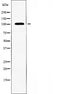 Western blot analysis of extracts from K562 cells, using TAF3 antibody.