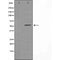 DF4577 staining LOVO cells by IF/ICC. The sample were fixed with PFA and permeabilized in 0.1% Triton X-100,then blocked in 10% serum for 45 minutes at 25¡ãC. The primary antibody was diluted at 1/200 and incubated with the sample for 1 hour at 37¡ãC. An  Alexa Fluor 594 conjugated goat anti-rabbit IgG (H+L) antibody(Cat.# S0006), diluted at 1/600, was used as secondary antibod