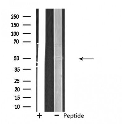 DF4578 staining Hela cells by IF/ICC. The sample were fixed with PFA and permeabilized in 0.1% Triton X-100,then blocked in 10% serum for 45 minutes at 25¡ãC. The primary antibody was diluted at 1/200 and incubated with the sample for 1 hour at 37¡ãC. An  Alexa Fluor 594 conjugated goat anti-rabbit IgG (H+L) antibody(Cat.# S0006), diluted at 1/600, was used as secondary antibod