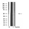 DF4578 staining Hela cells by IF/ICC. The sample were fixed with PFA and permeabilized in 0.1% Triton X-100,then blocked in 10% serum for 45 minutes at 25¡ãC. The primary antibody was diluted at 1/200 and incubated with the sample for 1 hour at 37¡ãC. An  Alexa Fluor 594 conjugated goat anti-rabbit IgG (H+L) antibody(Cat.# S0006), diluted at 1/600, was used as secondary antibod