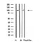 DF4584 staining HeLa by IF/ICC. The sample were fixed with PFA and permeabilized in 0.1% Triton X-100,then blocked in 10% serum for 45 minutes at 25¡ãC. The primary antibody was diluted at 1/200 and incubated with the sample for 1 hour at 37¡ãC. An  Alexa Fluor 594 conjugated goat anti-rabbit IgG (H+L) Ab, diluted at 1/600, was used as the secondary antibod