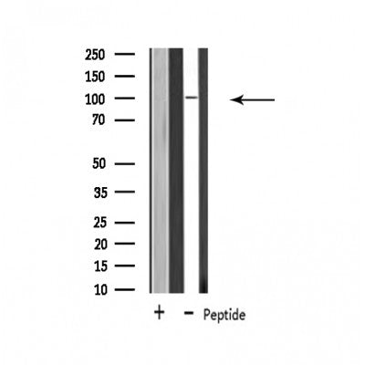 Western blot analysis of extracts from mouse brain, using USP11 Antibody. Lane 1 was treated with the blocking peptide.