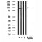 DF4587 at 1/100 staining Human  tissue by IHC-P. The sample was formaldehyde fixed and a heat mediated antigen retrieval step in citrate buffer was performed. The sample was then blocked and incubated with the antibody for 1.5 hours at 22¡ãC. An HRP conjugated goat anti-rabbit antibody was used as the secondary