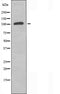 DF4588 staining  HeLa cells by IF/ICC. The sample were fixed with PFA and permeabilized in 0.1% Triton X-100,then blocked in 10% serum for 45 minutes at 25¡ãC. The primary antibody was diluted at 1/200 and incubated with the sample for 1 hour at 37¡ãC. An  Alexa Fluor 594 conjugated goat anti-rabbit IgG (H+L) antibody(Cat.# S0006), diluted at 1/600, was used as secondary antibod