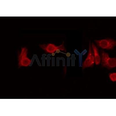 Western blot analysis of extracts from rat heart, using USP38 Antibody. Lane 1 was treated with the blocking peptide.