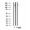 DF4592 staining LOVO by IF/ICC. The sample were fixed with PFA and permeabilized in 0.1% Triton X-100,then blocked in 10% serum for 45 minutes at 25¡ãC. The primary antibody was diluted at 1/200 and incubated with the sample for 1 hour at 37¡ãC. An  Alexa Fluor 594 conjugated goat anti-rabbit IgG (H+L) Ab, diluted at 1/600, was used as the secondary antibod