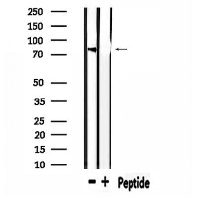 DF4594 staining HepG2 by IF/ICC. The sample were fixed with PFA and permeabilized in 0.1% Triton X-100,then blocked in 10% serum for 45 minutes at 25¡ãC. The primary antibody was diluted at 1/200 and incubated with the sample for 1 hour at 37¡ãC. An  Alexa Fluor 594 conjugated goat anti-rabbit IgG (H+L) Ab, diluted at 1/600, was used as the secondary antibod