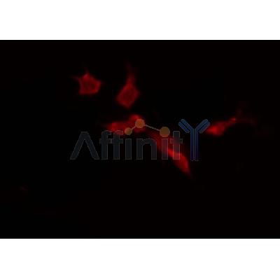 Western blot analysis of extracts from 293, using USP45 Antibody. Lane 1 was treated with the blocking peptide.