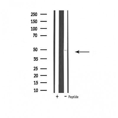 DF4596 staining Hela by IF/ICC. The sample were fixed with PFA and permeabilized in 0.1% Triton X-100,then blocked in 10% serum for 45 minutes at 25¡ãC. The primary antibody was diluted at 1/200 and incubated with the sample for 1 hour at 37¡ãC. An  Alexa Fluor 594 conjugated goat anti-rabbit IgG (H+L) Ab, diluted at 1/600, was used as the secondary antibod