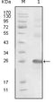 Figure 1: Western blot analysis using EphB3 mouse mAb against truncated EphB3-His recombinant protein.