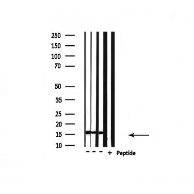 DF4600 staining  HeLa cells by IF/ICC. The sample were fixed with PFA and permeabilized in 0.1% Triton X-100,then blocked in 10% serum for 45 minutes at 25¡ãC. The primary antibody was diluted at 1/200 and incubated with the sample for 1 hour at 37¡ãC. An  Alexa Fluor 594 conjugated goat anti-rabbit IgG (H+L) antibody(Cat.# S0006), diluted at 1/600, was used as secondary antibod