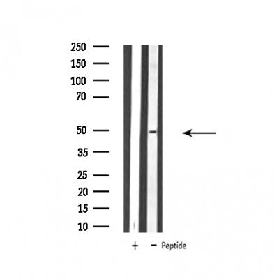 Western blot analysis of extracts from various samples, using ATP6V1C2 Antibody.
 Lane 1: 293 treated with blocking peptide.
 Lane 2: 293;
 Lane 3: Hela;
 