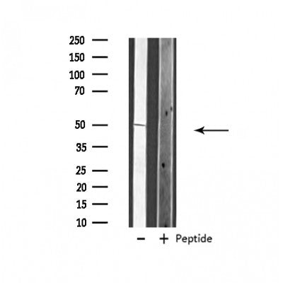 Western blot analysis of extracts from 293, using VANGL1 Antibody. Lane 1 was treated with the blocking peptide.