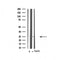 DF4610 staining HuvEc cells by IF/ICC. The sample were fixed with PFA and permeabilized in 0.1% Triton X-100,then blocked in 10% serum for 45 minutes at 25¡ãC. The primary antibody was diluted at 1/200 and incubated with the sample for 1 hour at 37¡ãC. An  Alexa Fluor 594 conjugated goat anti-rabbit IgG (H+L) antibody(Cat.# S0006), diluted at 1/600, was used as secondary antibod