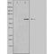 DF4611 staining CoLo cells by IF/ICC. The sample were fixed with PFA and permeabilized in 0.1% Triton X-100,then blocked in 10% serum for 45 minutes at 25¡ãC. The primary antibody was diluted at 1/200 and incubated with the sample for 1 hour at 37¡ãC. An  Alexa Fluor 594 conjugated goat anti-rabbit IgG (H+L) antibody(Cat.# S0006), diluted at 1/600, was used as secondary antibod