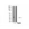 DF4612 staining HeLa by IF/ICC. The sample were fixed with PFA and permeabilized in 0.1% Triton X-100,then blocked in 10% serum for 45 minutes at 25¡ãC. The primary antibody was diluted at 1/200 and incubated with the sample for 1 hour at 37¡ãC. An  Alexa Fluor 594 conjugated goat anti-rabbit IgG (H+L) Ab, diluted at 1/600, was used as the secondary antibod