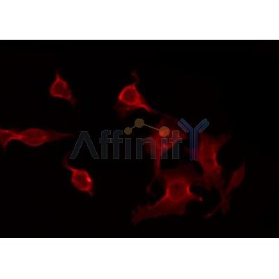 Western blot analysis of extracts from rat heart, using CACNG7 Antibody.