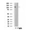 DF4614 staining 293 by IF/ICC. The sample were fixed with PFA and permeabilized in 0.1% Triton X-100,then blocked in 10% serum for 45 minutes at 25¡ãC. The primary antibody was diluted at 1/200 and incubated with the sample for 1 hour at 37¡ãC. An  Alexa Fluor 594 conjugated goat anti-rabbit IgG (H+L) Ab, diluted at 1/600, was used as the secondary antibod