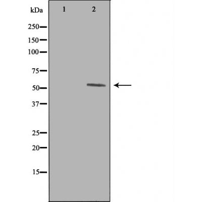 DF4616 staining Hela cells by IF/ICC. The sample were fixed with PFA and permeabilized in 0.1% Triton X-100,then blocked in 10% serum for 45 minutes at 25¡ãC. The primary antibody was diluted at 1/200 and incubated with the sample for 1 hour at 37¡ãC. An  Alexa Fluor 594 conjugated goat anti-rabbit IgG (H+L) antibody(Cat.# S0006), diluted at 1/600, was used as secondary antibod