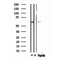 DF4617 staining  HuvEc cells by IF/ICC. The sample were fixed with PFA and permeabilized in 0.1% Triton X-100,then blocked in 10% serum for 45 minutes at 25¡ãC. The primary antibody was diluted at 1/200 and incubated with the sample for 1 hour at 37¡ãC. An  Alexa Fluor 594 conjugated goat anti-rabbit IgG (H+L) antibody(Cat.# S0006), diluted at 1/600, was used as secondary antibod
