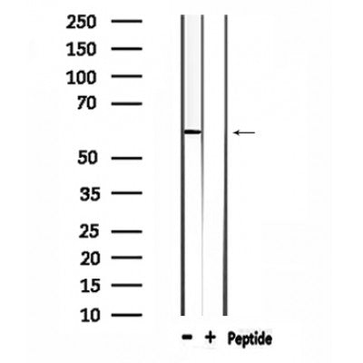DF4619 at 1/100 staining Human brain cancer tissue by IHC-P. The sample was formaldehyde fixed and a heat mediated antigen retrieval step in citrate buffer was performed. The sample was then blocked and incubated with the antibody for 1.5 hours at 22¡ãC. An HRP conjugated goat anti-rabbit antibody was used as the secondary