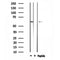 DF4619 at 1/100 staining Human brain cancer tissue by IHC-P. The sample was formaldehyde fixed and a heat mediated antigen retrieval step in citrate buffer was performed. The sample was then blocked and incubated with the antibody for 1.5 hours at 22¡ãC. An HRP conjugated goat anti-rabbit antibody was used as the secondary