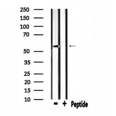 DF4621 staining HepG2 by IF/ICC. The sample were fixed with PFA and permeabilized in 0.1% Triton X-100,then blocked in 10% serum for 45 minutes at 25¡ãC. The primary antibody was diluted at 1/200 and incubated with the sample for 1 hour at 37¡ãC. An  Alexa Fluor 594 conjugated goat anti-rabbit IgG (H+L) Ab, diluted at 1/600, was used as the secondary antibod