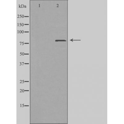 DF4622 staining MCF7 by IF/ICC. The sample were fixed with PFA and permeabilized in 0.1% Triton X-100,then blocked in 10% serum for 45 minutes at 25¡ãC. The primary antibody was diluted at 1/200 and incubated with the sample for 1 hour at 37¡ãC. An  Alexa Fluor 594 conjugated goat anti-rabbit IgG (H+L) Ab, diluted at 1/600, was used as the secondary antibod