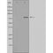 DF4622 staining MCF7 by IF/ICC. The sample were fixed with PFA and permeabilized in 0.1% Triton X-100,then blocked in 10% serum for 45 minutes at 25¡ãC. The primary antibody was diluted at 1/200 and incubated with the sample for 1 hour at 37¡ãC. An  Alexa Fluor 594 conjugated goat anti-rabbit IgG (H+L) Ab, diluted at 1/600, was used as the secondary antibod