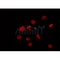 Western blot analysis of extracts from Hela, using ZC3H13 Antibody. Lane 1 was treated with the blocking peptide.