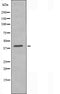 DF4624 staining Hela by IF/ICC. The sample were fixed with PFA and permeabilized in 0.1% Triton X-100,then blocked in 10% serum for 45 minutes at 25¡ãC. The primary antibody was diluted at 1/200 and incubated with the sample for 1 hour at 37¡ãC. An  Alexa Fluor 594 conjugated goat anti-rabbit IgG (H+L) Ab, diluted at 1/600, was used as the secondary antibod