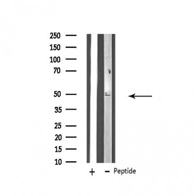 Western blot analysis of extracts from Hela, using ZFYVE19 Antibody. Lane 1 was treated with the blocking peptide.