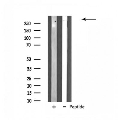 DF4626 staining HUVEC by IF/ICC. The sample were fixed with PFA and permeabilized in 0.1% Triton X-100,then blocked in 10% serum for 45 minutes at 25¡ãC. The primary antibody was diluted at 1/200 and incubated with the sample for 1 hour at 37¡ãC. An  Alexa Fluor 594 conjugated goat anti-rabbit IgG (H+L) Ab, diluted at 1/600, was used as the secondary antibod