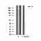 DF4626 staining HUVEC by IF/ICC. The sample were fixed with PFA and permeabilized in 0.1% Triton X-100,then blocked in 10% serum for 45 minutes at 25¡ãC. The primary antibody was diluted at 1/200 and incubated with the sample for 1 hour at 37¡ãC. An  Alexa Fluor 594 conjugated goat anti-rabbit IgG (H+L) Ab, diluted at 1/600, was used as the secondary antibod