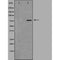 DF4627 staining K562 by IF/ICC. The sample were fixed with PFA and permeabilized in 0.1% Triton X-100,then blocked in 10% serum for 45 minutes at 25¡ãC. The primary antibody was diluted at 1/200 and incubated with the sample for 1 hour at 37¡ãC. An  Alexa Fluor 594 conjugated goat anti-rabbit IgG (H+L) Ab, diluted at 1/600, was used as the secondary antibod