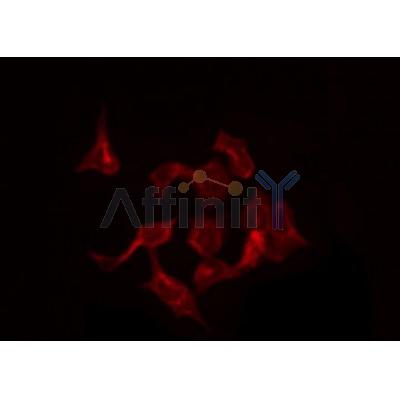 DF4632 staining Hela by IF/ICC. The samples were fixed with PFA and permeabilized in 0.1% Triton X-100,then blocked in 10% serum for 45 minutes at 25¡ãC. Samples were then incubated with primary Ab(DF4632 1:200) and mouse anti-beta tubulin Ab(T0023 1:200) for 1 hour at 37¡ãC. An  AlexaFluor594 conjugated goat anti-rabbit IgG(H+L) Ab(S0006 Red 1:600) and an AlexaFluor488 conjugated goat anti-mouse IgG(H+L) Ab(S0017 Green 1:600) were used as the secondary antibod