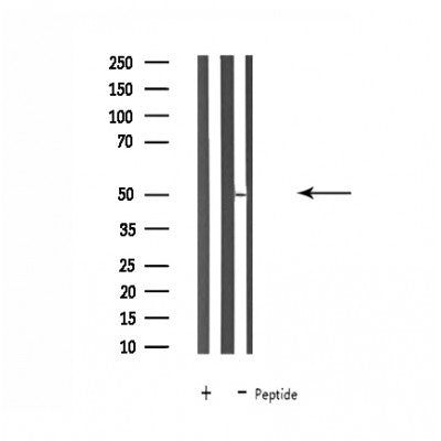 DF4633 at 1/100 staining Human lung cancer tissue by IHC-P. The sample was formaldehyde fixed and a heat mediated antigen retrieval step in citrate buffer was performed. The sample was then blocked and incubated with the antibody for 1.5 hours at 22¡ãC. An HRP conjugated goat anti-rabbit antibody was used as the secondary