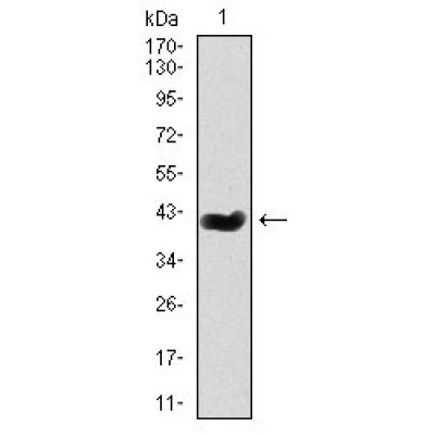 DF4653 staining  HepG2 cells by IF/ICC. The sample were fixed with PFA and permeabilized in 0.1% Triton X-100,then blocked in 10% serum for 45 minutes at 25¡ãC. The primary antibody was diluted at 1/200 and incubated with the sample for 1 hour at 37¡ãC. An  Alexa Fluor 594 conjugated goat anti-rabbit IgG (H+L) antibody(Cat.# S0006), diluted at 1/600, was used as secondary antibod