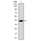 DF4653 staining  HepG2 cells by IF/ICC. The sample were fixed with PFA and permeabilized in 0.1% Triton X-100,then blocked in 10% serum for 45 minutes at 25¡ãC. The primary antibody was diluted at 1/200 and incubated with the sample for 1 hour at 37¡ãC. An  Alexa Fluor 594 conjugated goat anti-rabbit IgG (H+L) antibody(Cat.# S0006), diluted at 1/600, was used as secondary antibod