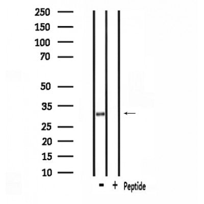 DF4655 staining Hela by IF/ICC. The sample were fixed with PFA and permeabilized in 0.1% Triton X-100,then blocked in 10% serum for 45 minutes at 25¡ãC. The primary antibody was diluted at 1/200 and incubated with the sample for 1 hour at 37¡ãC. An  Alexa Fluor 594 conjugated goat anti-rabbit IgG (H+L) Ab, diluted at 1/600, was used as the secondary antibod