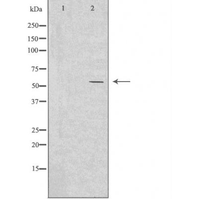DF4656 staining Hela by IF/ICC. The sample were fixed with PFA and permeabilized in 0.1% Triton X-100,then blocked in 10% serum for 45 minutes at 25¡ãC. The primary antibody was diluted at 1/200 and incubated with the sample for 1 hour at 37¡ãC. An  Alexa Fluor 594 conjugated goat anti-rabbit IgG (H+L) Ab, diluted at 1/600, was used as the secondary antibod