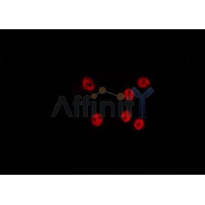 DF4657 staining HepG2 by IF/ICC. The sample were fixed with PFA and permeabilized in 0.1% Triton X-100,then blocked in 10% serum for 45 minutes at 25¡ãC. The primary antibody was diluted at 1/200 and incubated with the sample for 1 hour at 37¡ãC. An  Alexa Fluor 594 conjugated goat anti-rabbit IgG (H+L) Ab, diluted at 1/600, was used as the secondary antibod