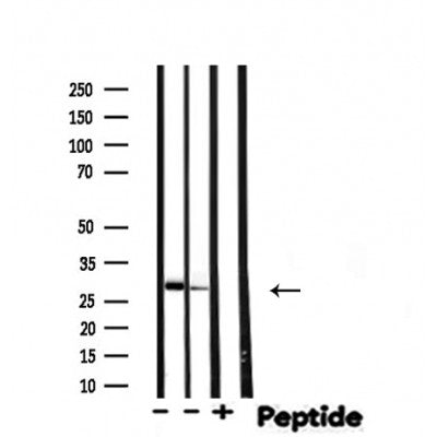 DF4664 staining  LOVO cells by IF/ICC. The sample were fixed with PFA and permeabilized in 0.1% Triton X-100,then blocked in 10% serum for 45 minutes at 25¡ãC. The primary antibody was diluted at 1/200 and incubated with the sample for 1 hour at 37¡ãC. An  Alexa Fluor 594 conjugated goat anti-rabbit IgG (H+L) antibody(Cat.