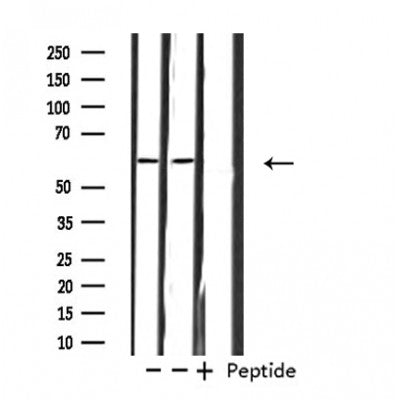 DF4668 staining HepG2 by IF/ICC. The sample were fixed with PFA and permeabilized in 0.1% Triton X-100,then blocked in 10% serum for 45 minutes at 25¡ãC. The primary antibody was diluted at 1/200 and incubated with the sample for 1 hour at 37¡ãC. An  Alexa Fluor 594 conjugated goat anti-rabbit IgG (H+L) Ab, diluted at 1/600, was used as the secondary antibod