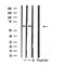 DF4668 staining HepG2 by IF/ICC. The sample were fixed with PFA and permeabilized in 0.1% Triton X-100,then blocked in 10% serum for 45 minutes at 25¡ãC. The primary antibody was diluted at 1/200 and incubated with the sample for 1 hour at 37¡ãC. An  Alexa Fluor 594 conjugated goat anti-rabbit IgG (H+L) Ab, diluted at 1/600, was used as the secondary antibod