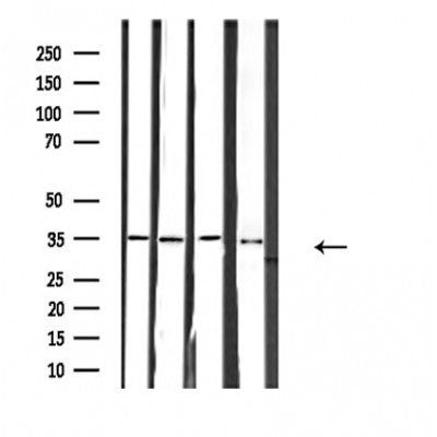 DF4669 staining HepG2 by IF/ICC. The sample were fixed with PFA and permeabilized in 0.1% Triton X-100,then blocked in 10% serum for 45 minutes at 25¡ãC. The primary antibody was diluted at 1/200 and incubated with the sample for 1 hour at 37¡ãC. An  Alexa Fluor 594 conjugated goat anti-rabbit IgG (H+L) Ab, diluted at 1/600, was used as the secondary antibod