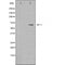 DF4672 staining HepG2 by IF/ICC. The sample were fixed with PFA and permeabilized in 0.1% Triton X-100,then blocked in 10% serum for 45 minutes at 25¡ãC. The primary antibody was diluted at 1/200 and incubated with the sample for 1 hour at 37¡ãC. An  Alexa Fluor 594 conjugated goat anti-rabbit IgG (H+L) Ab, diluted at 1/600, was used as the secondary antibod