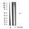 Western blot analysis of extracts from mouse lung and mouse brain, using SLC38A2 Antibody.